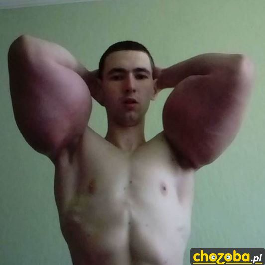 Nadmuchane bicepsy