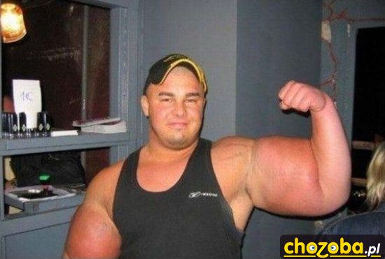 Biceps