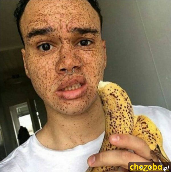 Zaraził się od banana
