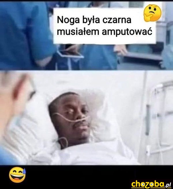 Czarna noga